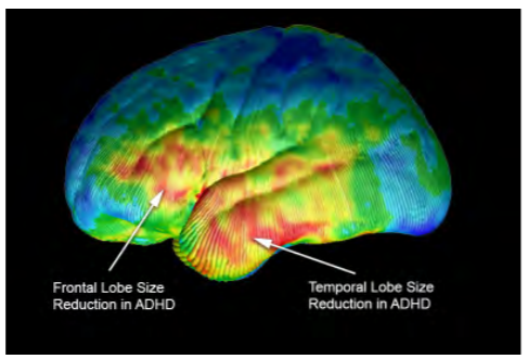 Improving Cognitive Performance in Aviation & Other Military ...