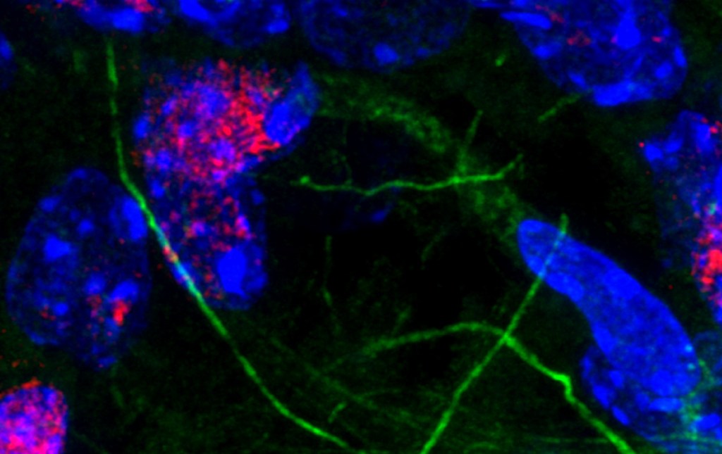 Immunofluorescent staining of mouse brain, showing neurons and glial cells in the hippocampus. Blue are cell nuclei, while green are microfilaments of the cell extensions. Red is a marker of DNA damage and is predominantly in the neurons. Aris Polyzos/Berkeley Lab