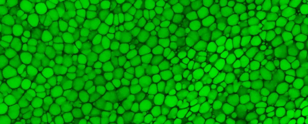 “Lipocartilage” is a type of supportive skeletal tissue, that consists of densely packed, bubble-like cells containing fat. This image shows a scan of mouse ear lipocartilage stained with a green fluorescent dye. Credit: Plikus Lab/University of California, Irvine