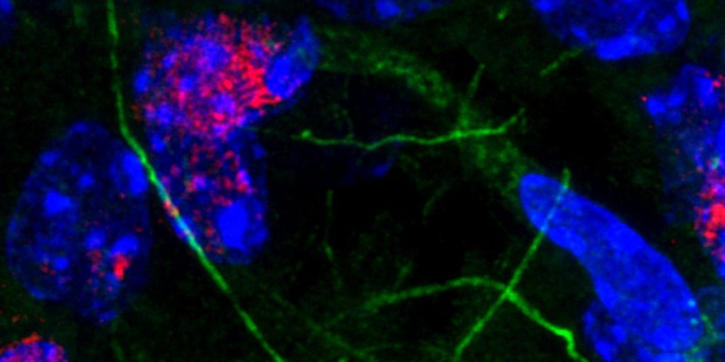 Immunofluorescent staining of mouse brain, showing neurons and glial cells in the hippocampus. Blue are cell nuclei, while green are microfilaments of the cell extensions. Red is a marker of DNA damage and is predominantly in the neurons. Aris Polyzos/Berkeley Lab