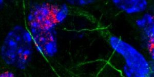 Immunofluorescent staining of mouse brain, showing neurons and glial cells in the hippocampus. Blue are cell nuclei, while green are microfilaments of the cell extensions. Red is a marker of DNA damage and is predominantly in the neurons. Aris Polyzos/Berkeley Lab